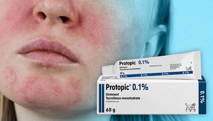 protopic tacrolimus