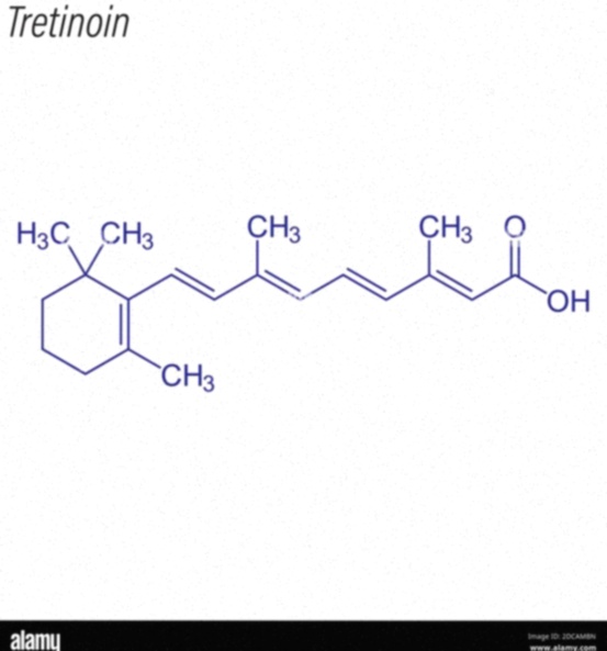 tretinoina